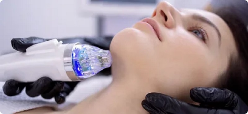 Advanced Microneedling Techniques for Skin Renewal and Repair